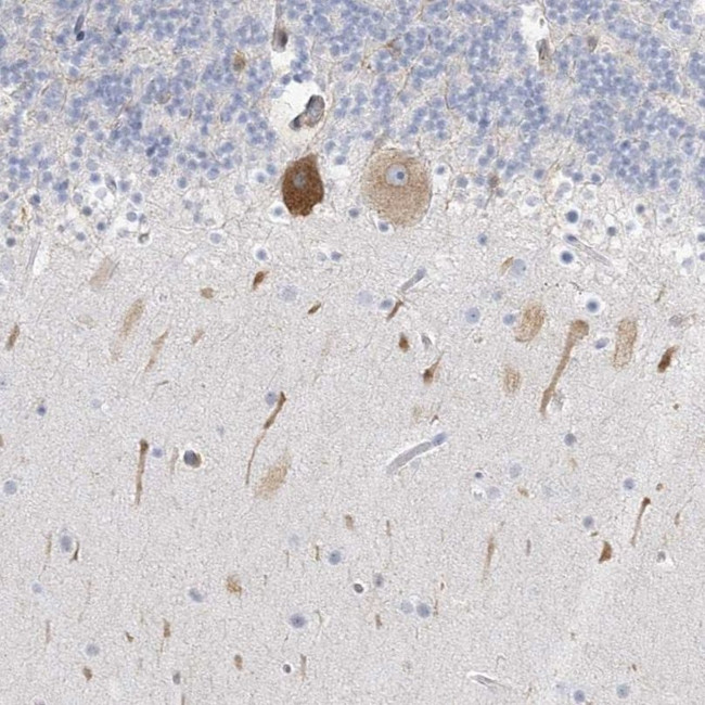 ICMT Antibody in Immunohistochemistry (IHC)