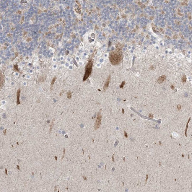 ICMT Antibody in Immunohistochemistry (IHC)