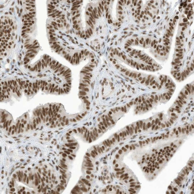 SF3A3 Antibody in Immunohistochemistry (IHC)