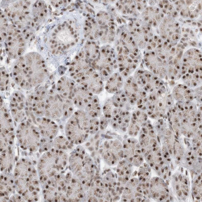 SF3A3 Antibody in Immunohistochemistry (IHC)