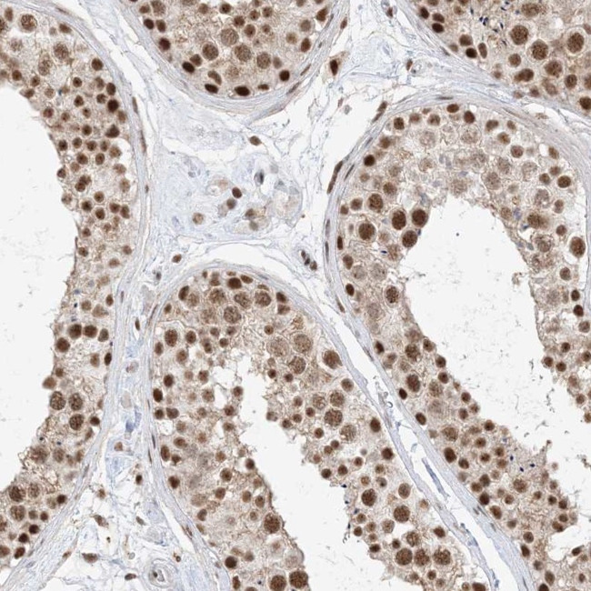 SF3A3 Antibody in Immunohistochemistry (IHC)