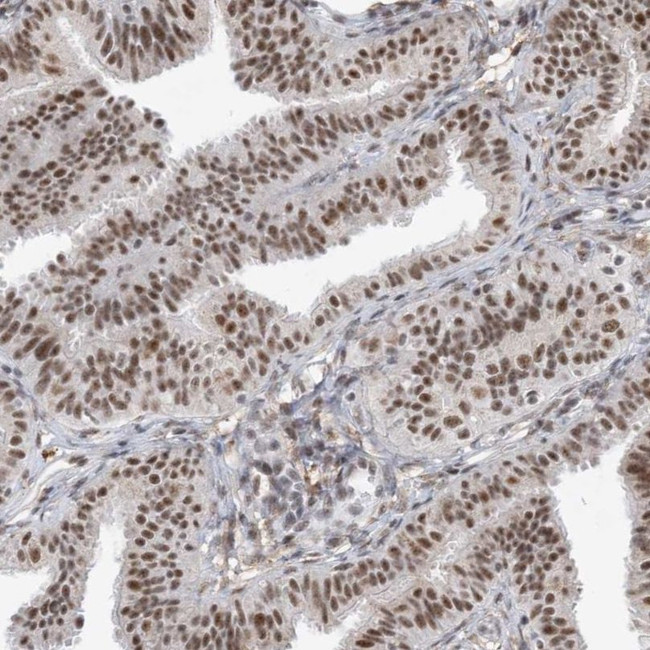 SF3A3 Antibody in Immunohistochemistry (IHC)