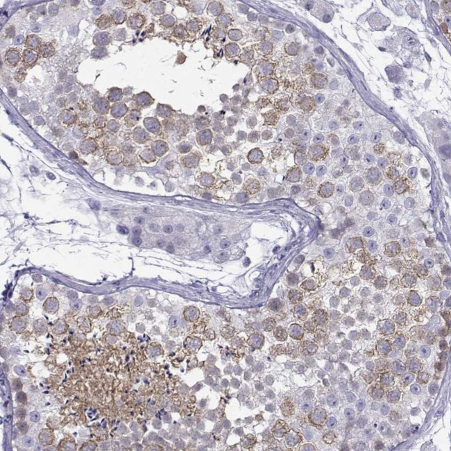 KIF17 Antibody in Immunohistochemistry (IHC)