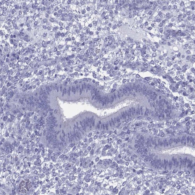 KIF17 Antibody in Immunohistochemistry (IHC)