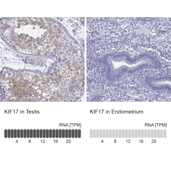 KIF17 Antibody