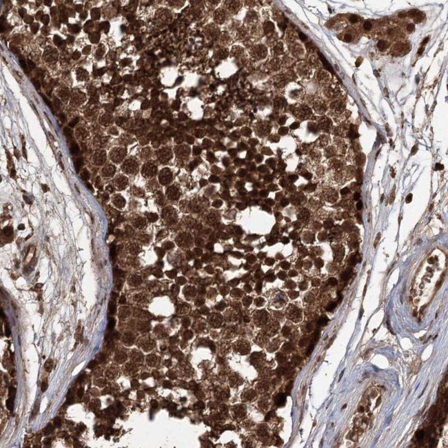 FBXO7 Antibody in Immunohistochemistry (IHC)