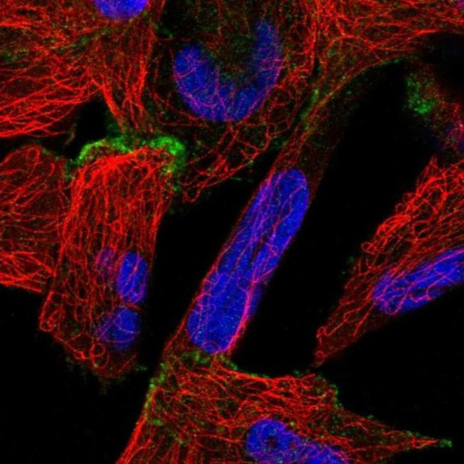 ORP6 Antibody in Immunocytochemistry (ICC/IF)