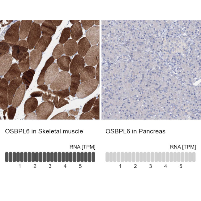 ORP6 Antibody in Immunohistochemistry (IHC)