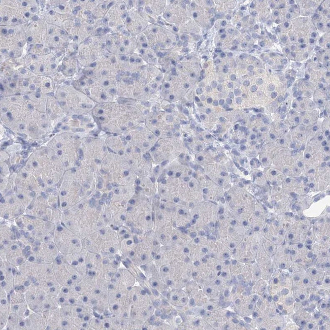 ORP6 Antibody in Immunohistochemistry (IHC)