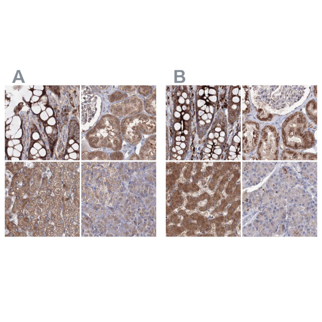 PEX13 Antibody in Immunohistochemistry (IHC)