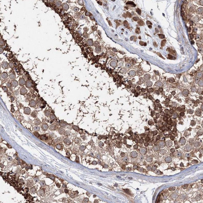 PEX13 Antibody in Immunohistochemistry (IHC)