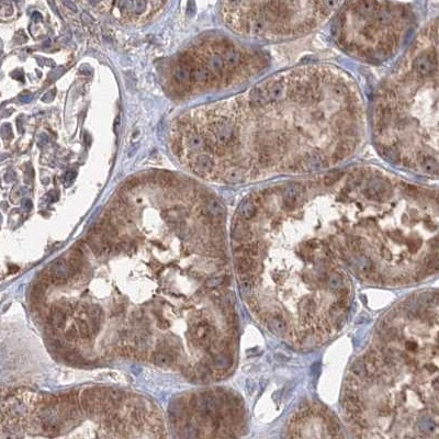 PEX13 Antibody in Immunohistochemistry (IHC)