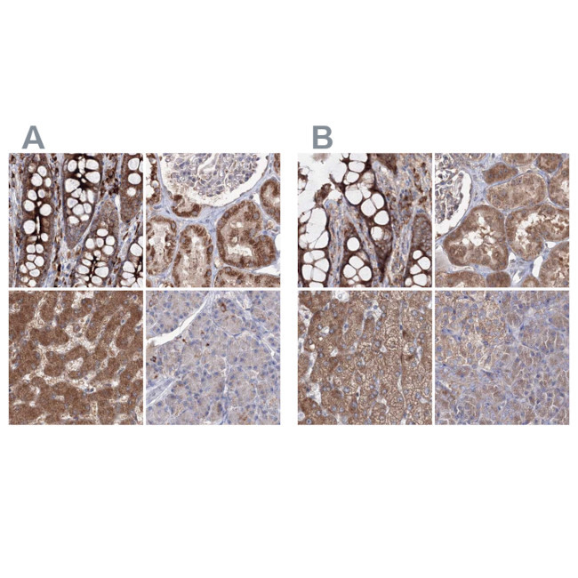 PEX13 Antibody in Immunohistochemistry (IHC)