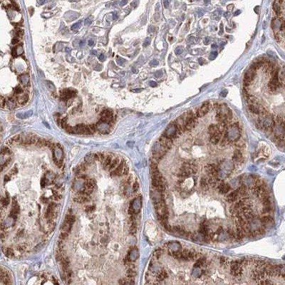 PEX13 Antibody in Immunohistochemistry (IHC)