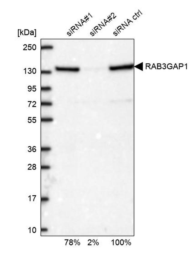 RAB3GAP1 Antibody in Western Blot (WB)