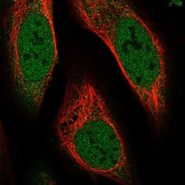 MAPK1IP1L Antibody in Immunocytochemistry (ICC/IF)