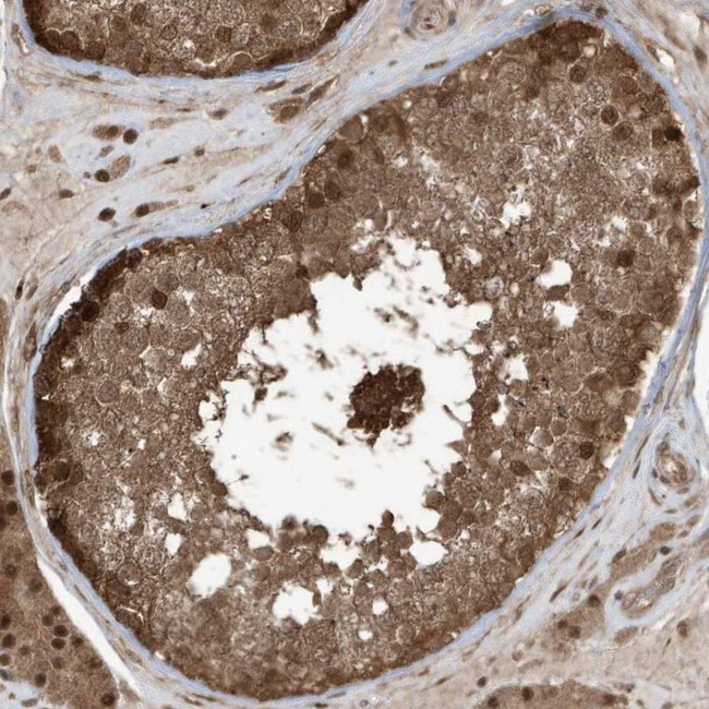 MAPK1IP1L Antibody in Immunohistochemistry (IHC)