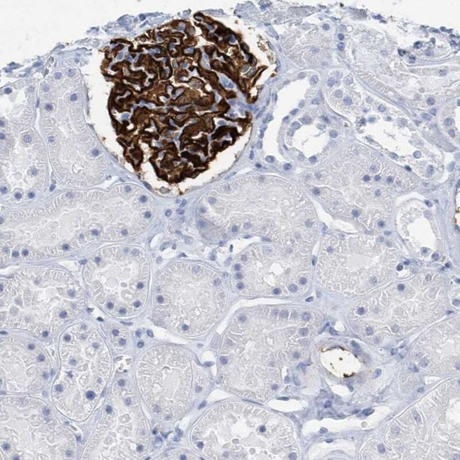 PTPRO Antibody in Immunohistochemistry (IHC)