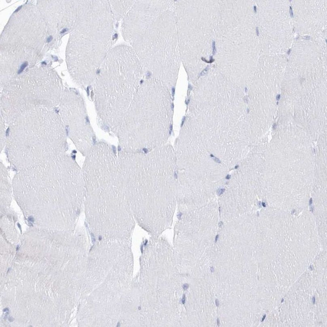 PTPRO Antibody in Immunohistochemistry (IHC)