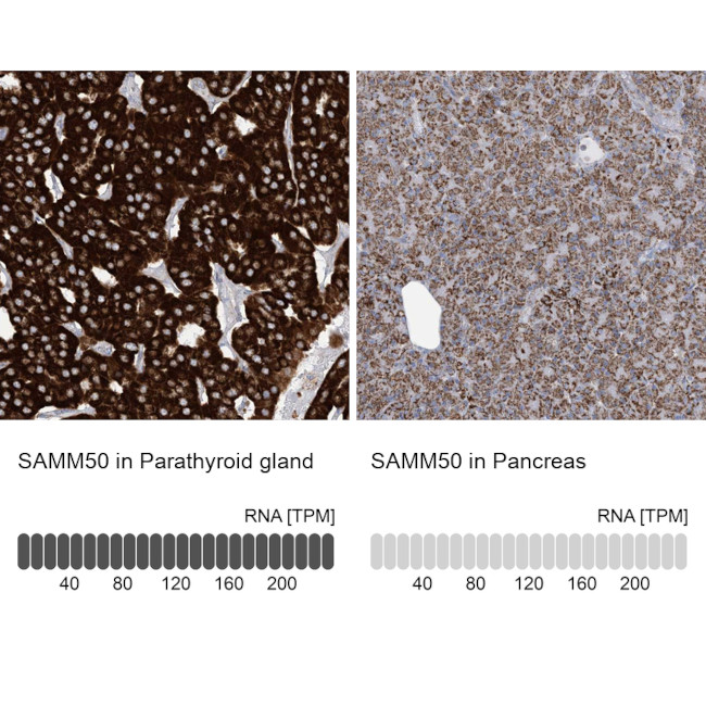 SAMM50 Antibody in Immunohistochemistry (IHC)