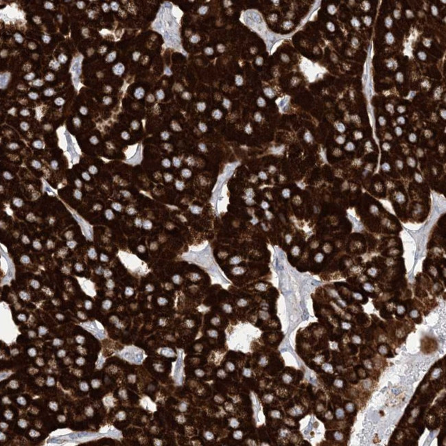 SAMM50 Antibody in Immunohistochemistry (IHC)