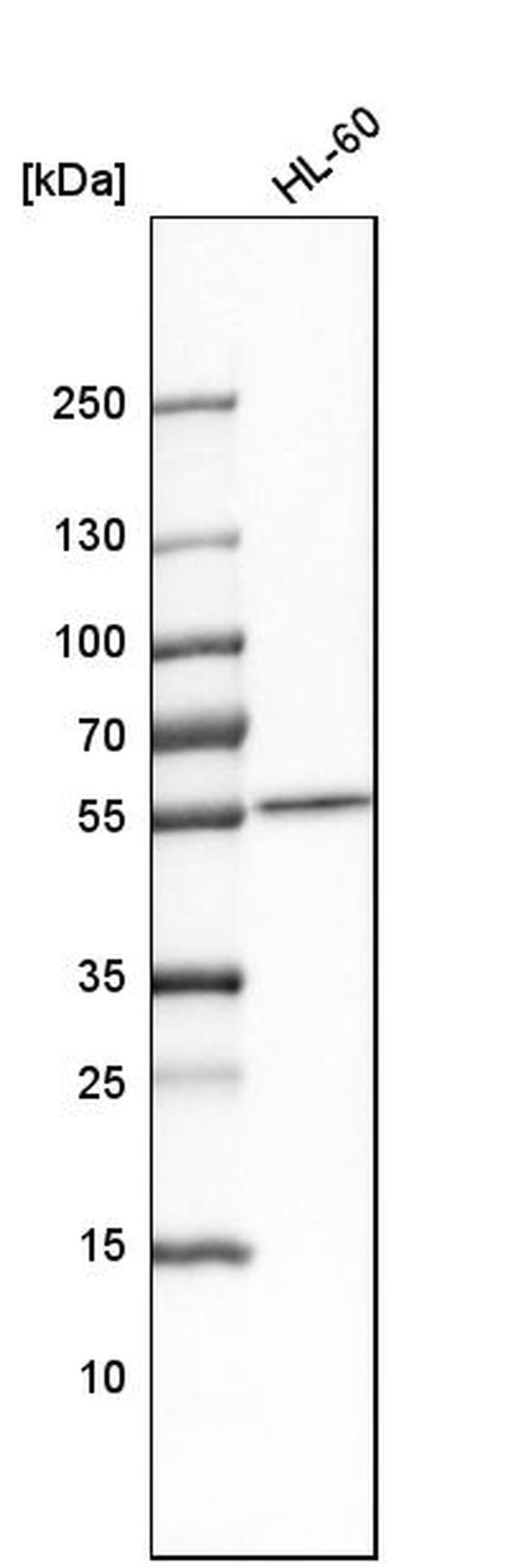 SAMM50 Antibody in Western Blot (WB)