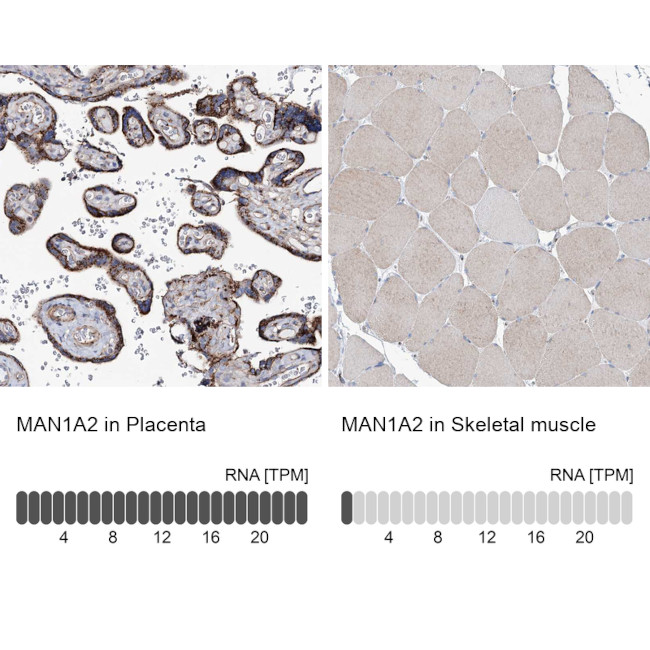MAN1A2 Antibody in Immunohistochemistry (IHC)