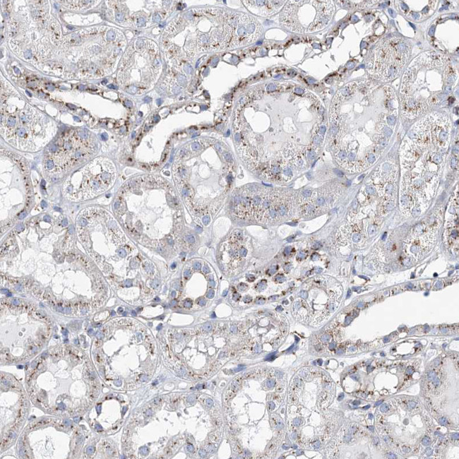 MAN1A2 Antibody in Immunohistochemistry (IHC)