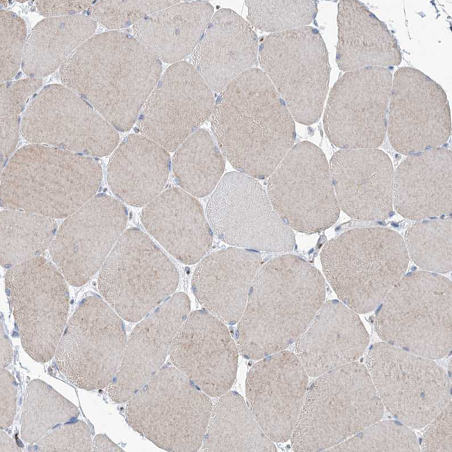 MAN1A2 Antibody in Immunohistochemistry (IHC)