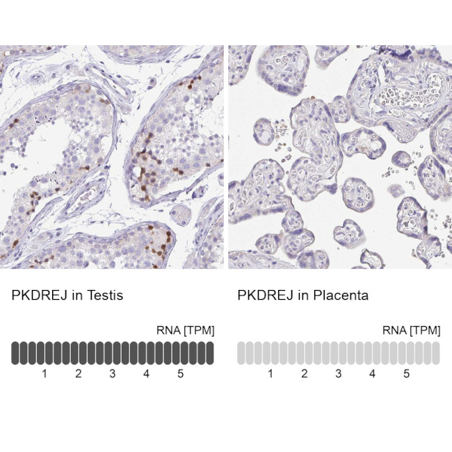 PKDREJ Antibody in Immunohistochemistry (IHC)