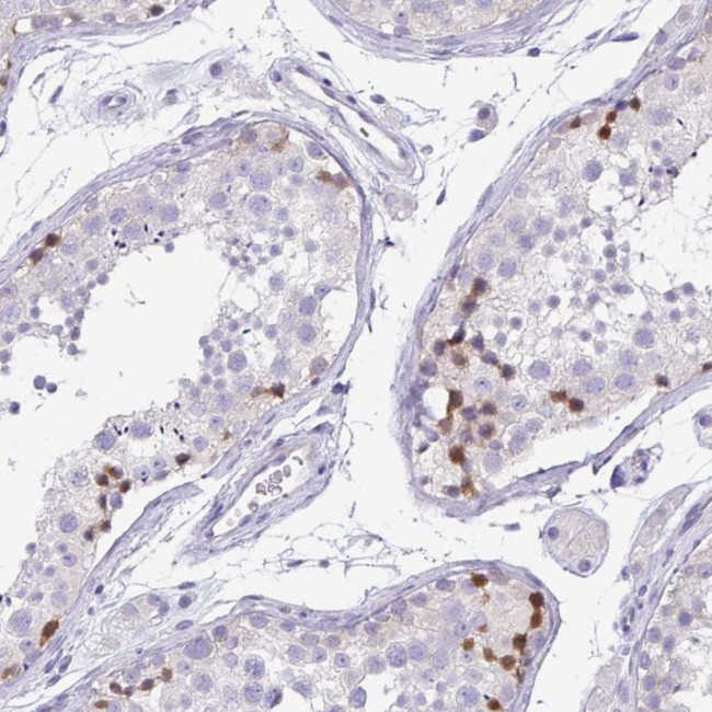 PKDREJ Antibody in Immunohistochemistry (IHC)