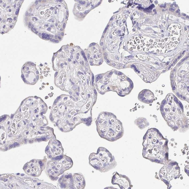 PKDREJ Antibody in Immunohistochemistry (IHC)