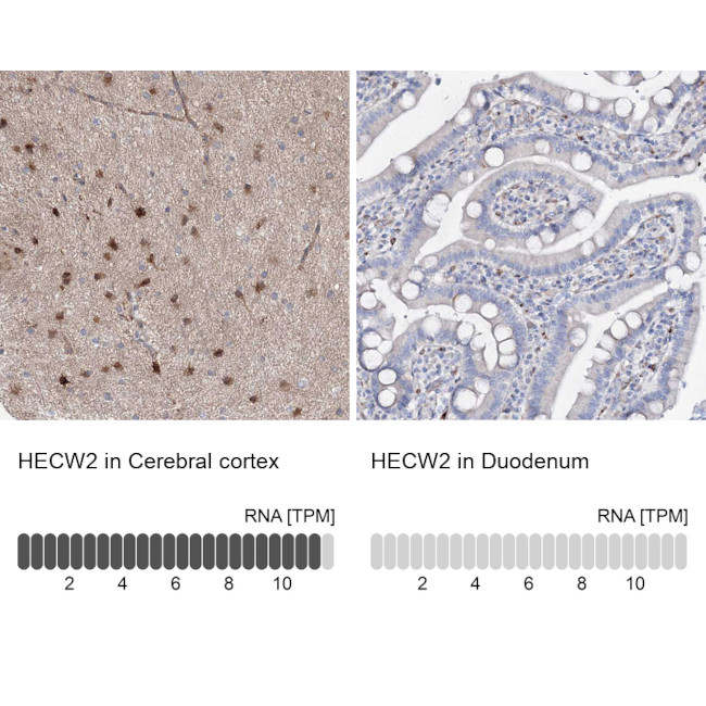 NEDL2 Antibody in Immunohistochemistry (IHC)