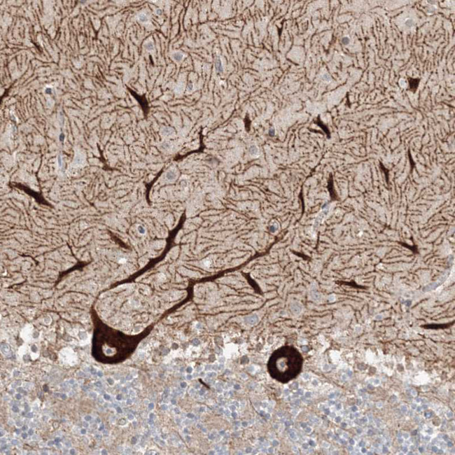 NEDL2 Antibody in Immunohistochemistry (IHC)