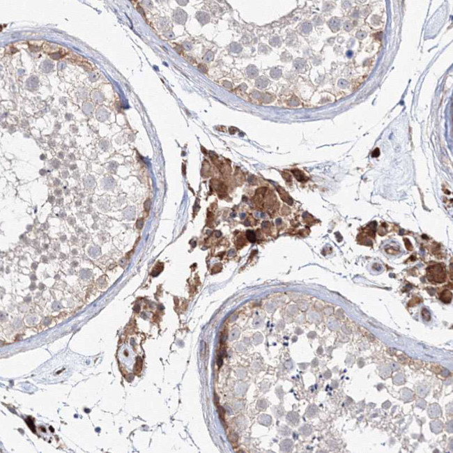 NEDL2 Antibody in Immunohistochemistry (IHC)