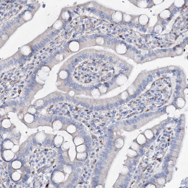 NEDL2 Antibody in Immunohistochemistry (IHC)