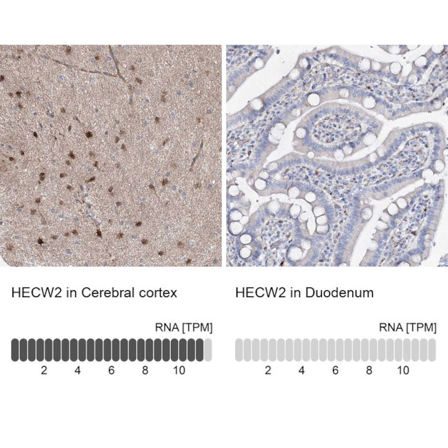 NEDL2 Antibody