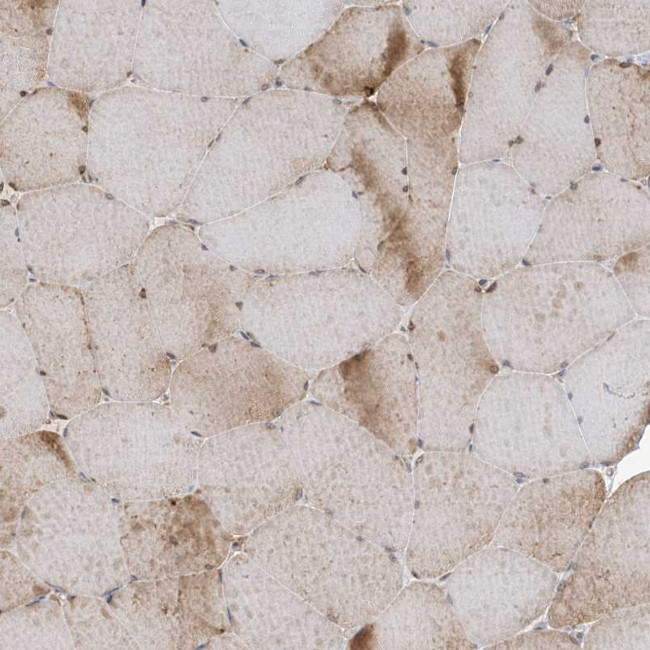 SRP72 Antibody in Immunohistochemistry (IHC)