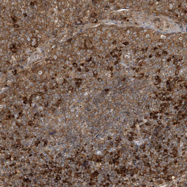 SRP72 Antibody in Immunohistochemistry (IHC)