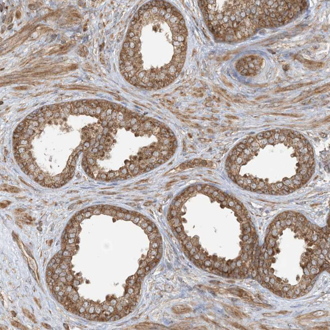 SRP72 Antibody in Immunohistochemistry (IHC)