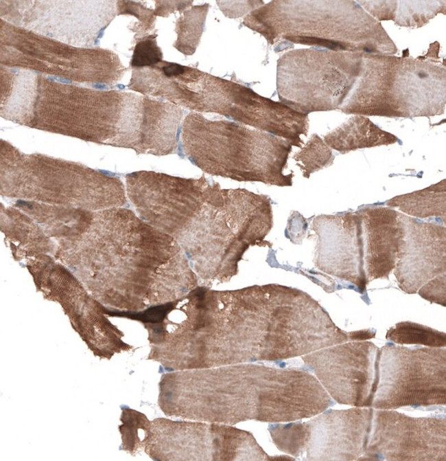 SYNPO Antibody in Immunohistochemistry (IHC)