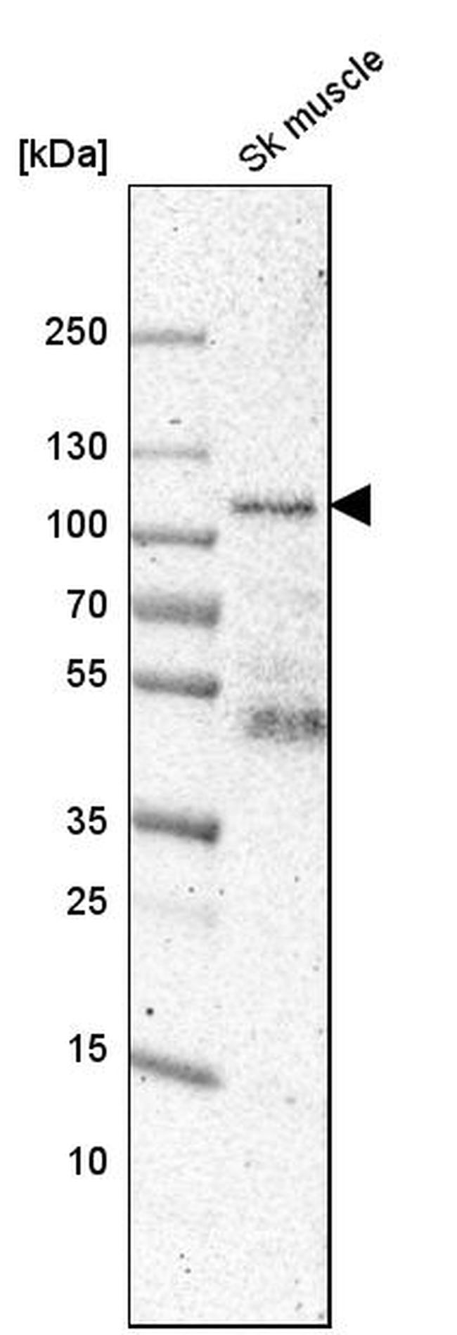 SYNPO Antibody in Western Blot (WB)