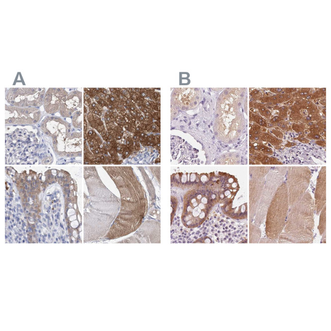 UGP2 Antibody in Immunohistochemistry (IHC)