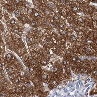 UGP2 Antibody in Immunohistochemistry (IHC)