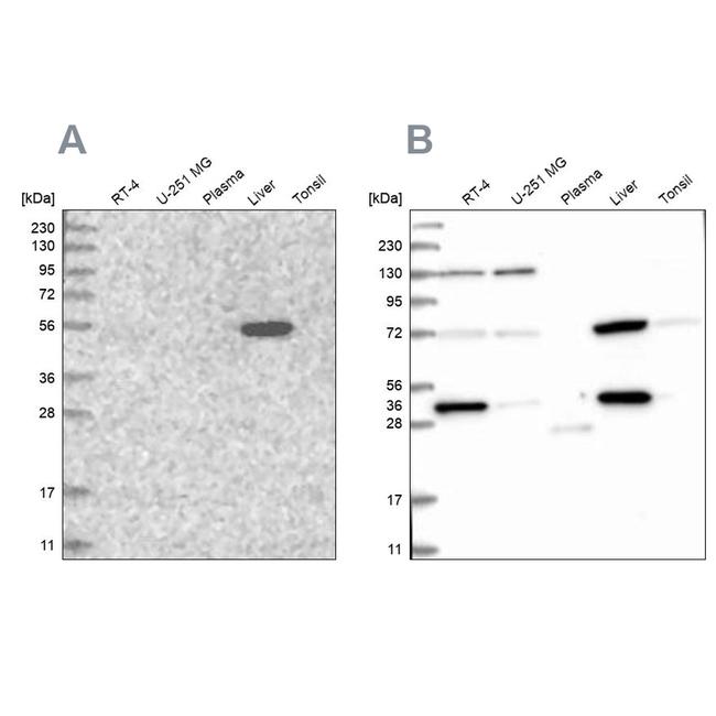 UGP2 Antibody in Western Blot (WB)