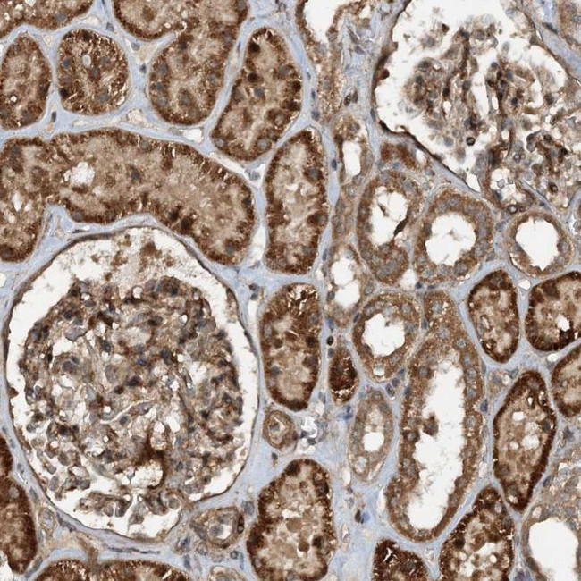 HEMK1 Antibody in Immunohistochemistry (IHC)