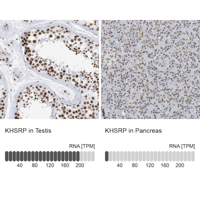 KHSRP Antibody in Immunohistochemistry (IHC)