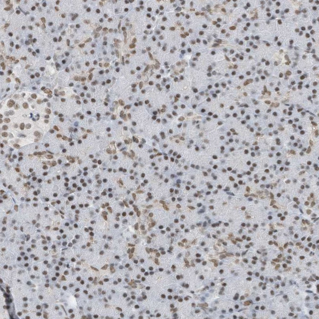 KHSRP Antibody in Immunohistochemistry (IHC)