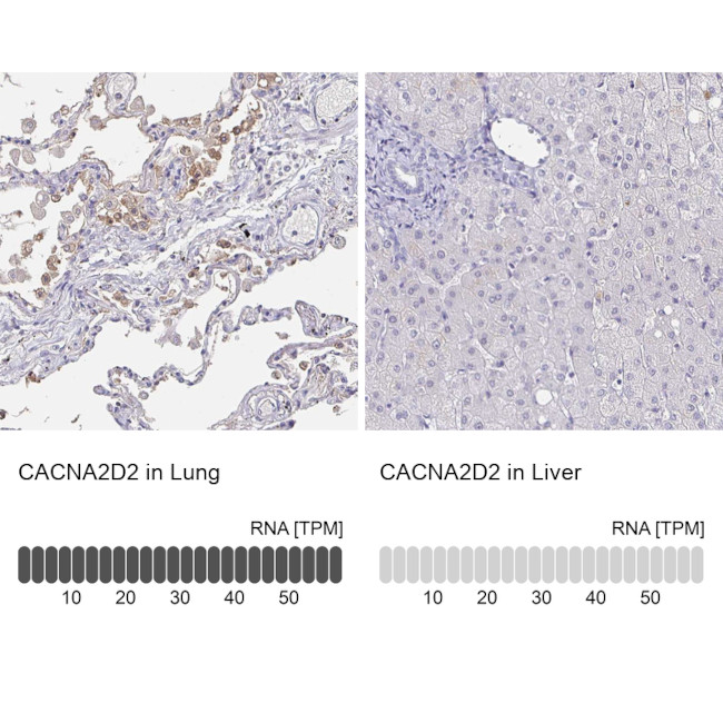 CACNA2D2 Antibody in Immunohistochemistry (IHC)