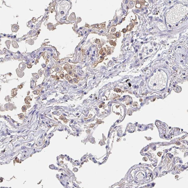 CACNA2D2 Antibody in Immunohistochemistry (IHC)